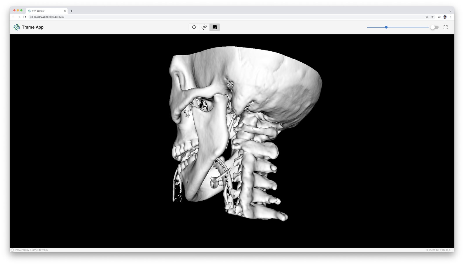 Computer visualization of a human skull in trame