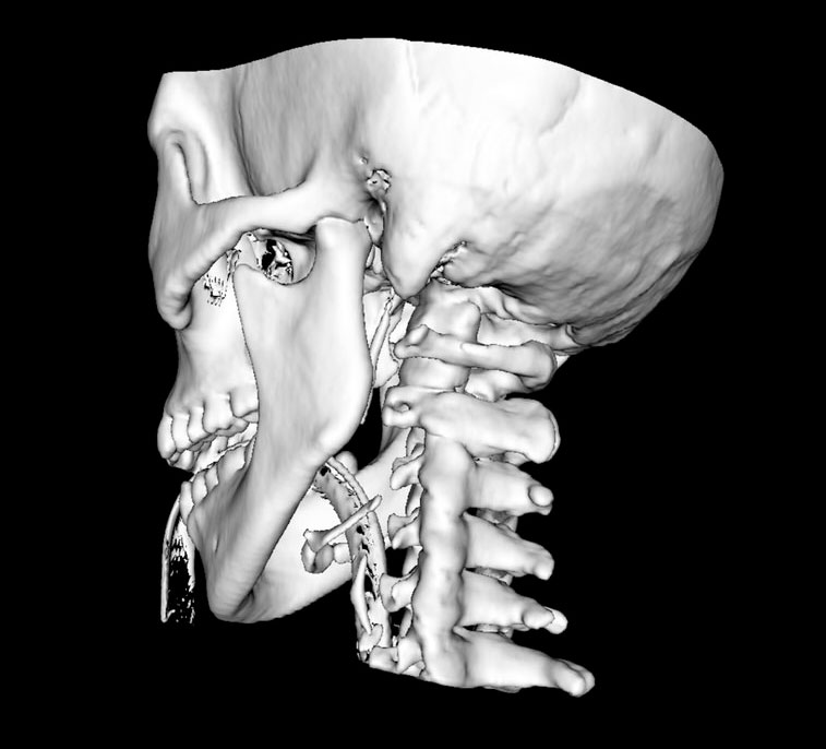 Computer visualization of a skull